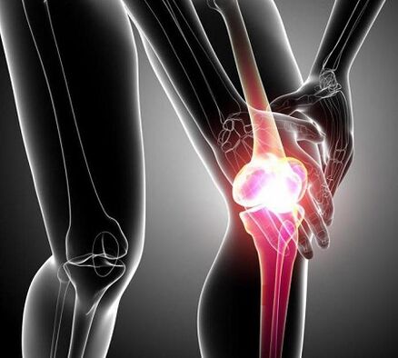 Schädigung des Kniegelenks durch Arthritis und Arthrose