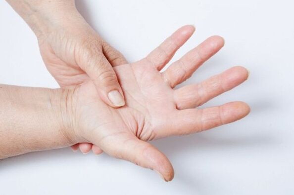 Taubheit der Hand ist eines der Symptome der lumbalen Osteochondrose