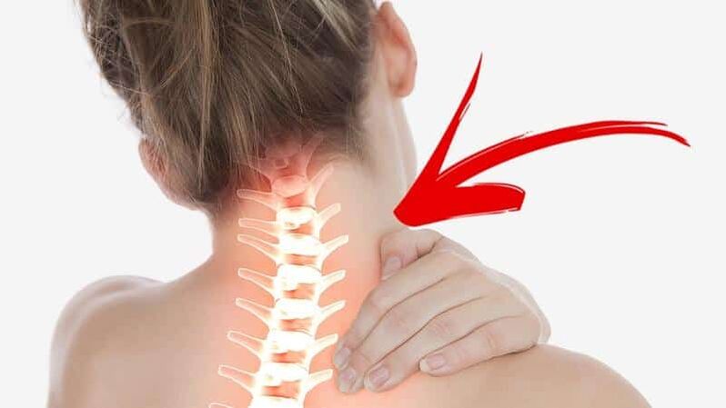 Zervikale Osteochondrose erfordert therapeutische Übungen