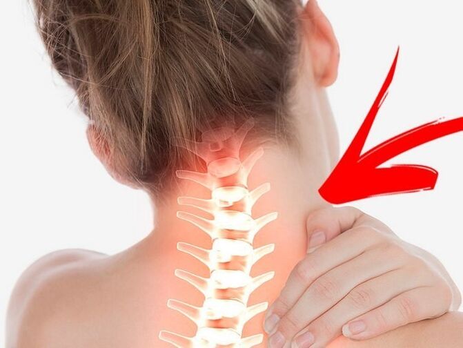Kompression von Nervenwurzeln mit zervikaler Osteochondrose